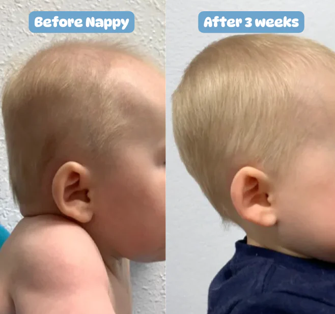 The paediatrician-approved pillow that prevents flat head